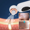 HexoSkin™ Hydrodermabrasion Éliminateur de Points Noirs