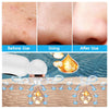 HexoSkin™ Hydrodermabrasion Éliminateur de Points Noirs