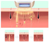 HexoSkin™ Dispositif d&#39;Epilation au Laser IPL